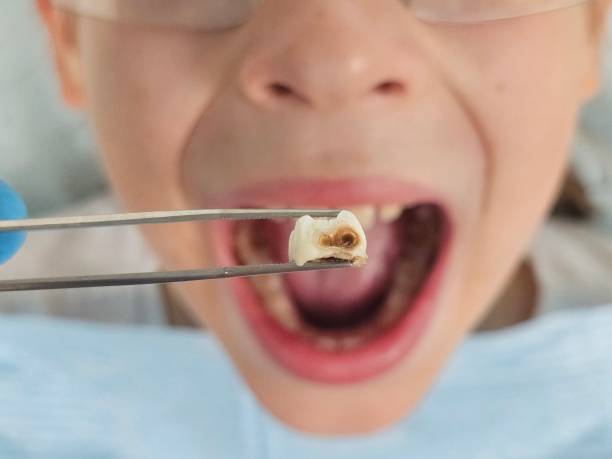 Best Walk-In Emergency Dental Services in Somerset, WI