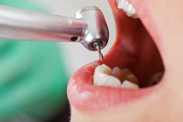 Best Emergency Root Canal Therapy in Somerset, WI